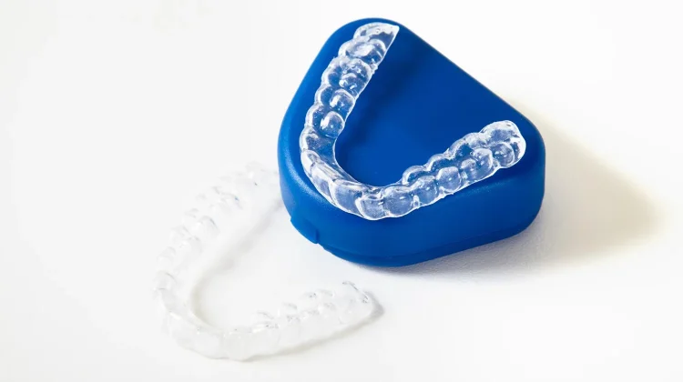 Behel Dilepas, Kenapa Masih Harus Pakai Retainer?
