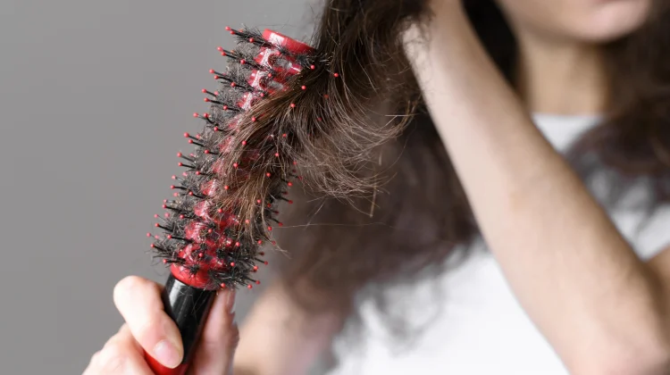 Penyebab Utama Rambut Sering Rontok