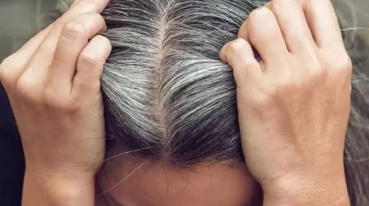 Rambut Beruban Jika Dirawat akan tetap Sehat