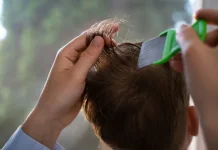 Kebiasaan Sehari-hari yang Bisa Menularkan Kutu Rambut