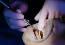 Kenapa Pasang Behel Harus di Orthodontis, Ini Alasannya