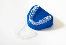 Behel Dilepas, Kenapa Masih Harus Pakai Retainer?