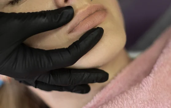 Sulam Bibir Makin Populer, Risikonya bagi Kesehatan