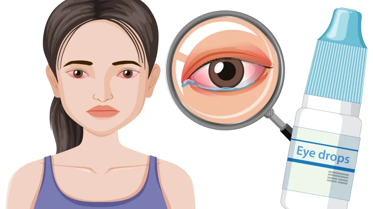 Menggunakan Obat Tetes Mata saat Puasa, Bolehkah?