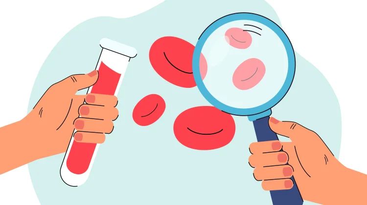 Peran Deteksi Dini dalam Penanganan Hemofilia yang Efektif