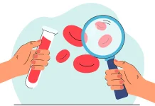 Peran Deteksi Dini dalam Penanganan Hemofilia yang Efektif