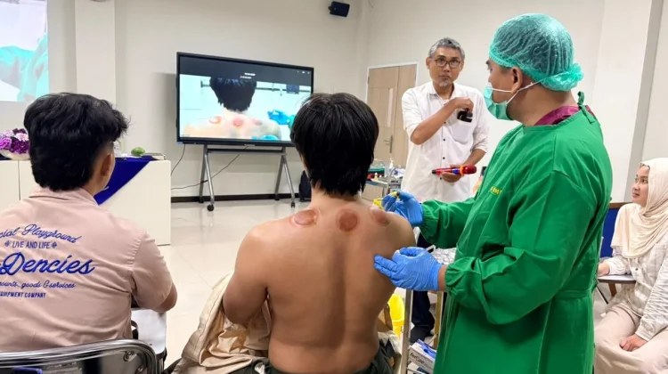 Mahasiswa FK UMP Antusias Ikuti Workshop Bekam Medis