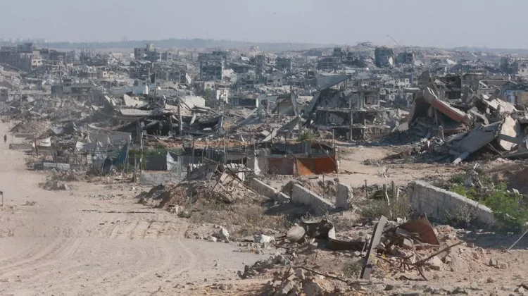 OCHA: Gaza Krisis Prostetik Parah, Ribuan Amputasi Tak Tertangani