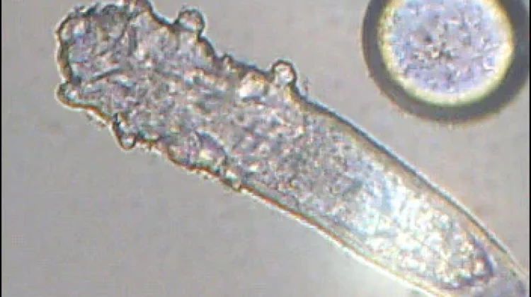 Mengenal Demodex, Tungau Mikroskopis yang Bisa Hidup di Kulit Wajah