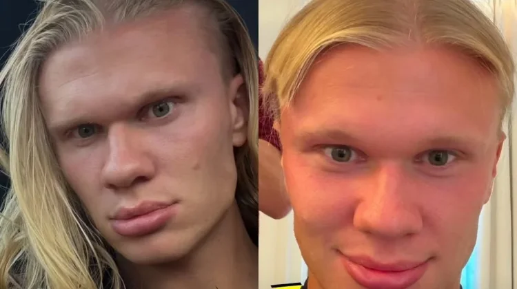 Erling Haaland Potong Rambut, Gaya Ikoniknya Berubah