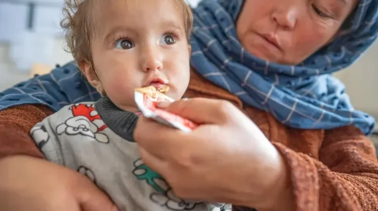 UNICEF: 3,7 Juta Anak di Afghanistan Alami "Wasting"
