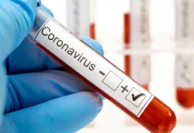 Legislator Ingatkan Pemerintah Antisipasi COVID-19 Cicada