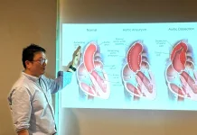 Penanganan Cepat Jadi Kunci Keselamatan Pasien Penyakit Aorta