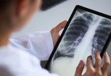 Selain Asap Rokok, Berikut 5 Penyebab Pneumonia yang Perlu Diwaspadai