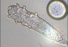 Mengenal Demodex, Tungau Mikroskopis yang Bisa Hidup di Kulit Wajah