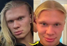 Erling Haaland Potong Rambut, Gaya Ikoniknya Berubah