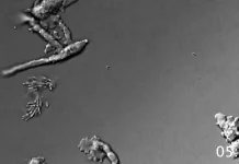 Amoeba “Api” Pecahkan Rekor, Mampu Berkembang Biak di Suhu 63 Derajat Celsius