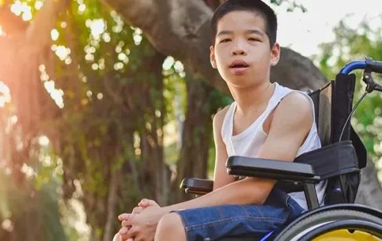 Hari Cerebral Palsy Sedunia, Pentingnya Mengenali Gejala sejak Dini