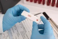 Tetapkan Krisis Nasional, Kasus HIV di Fiji Sampai 2.016 Kasus Sepanjang 2025