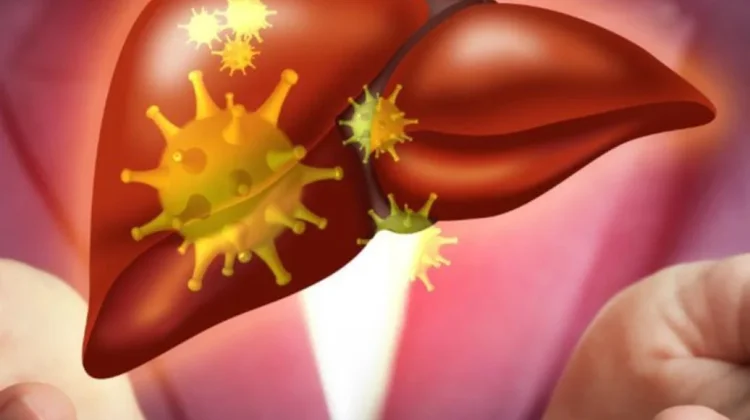 Penyebab Fatty Liver