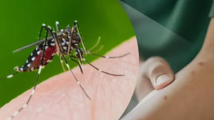 Waspadai Musim Penghujan, Masyarakat Diimbau Tingkatkan Upaya Pencegahan DBD