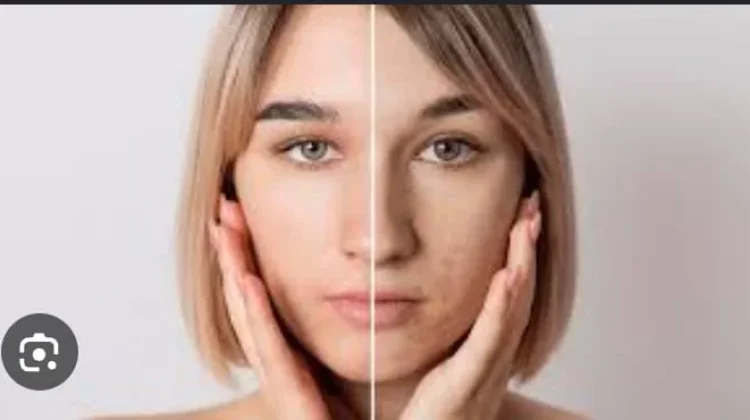 5  Alasan Wajah Glowing pada Pagi dan Kusam saat Sore