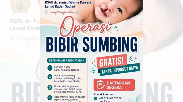 RSAU Lanud Raden Sadjad Gelar Operasi Bibir Sumbing Gratis