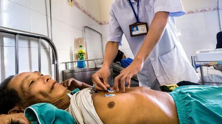 Mengenal Hari Kardiologi Intervensional Internasional Setiap 16 September