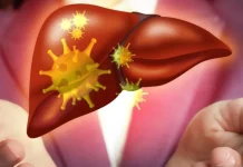 Penyebab Fatty Liver