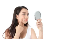 Menghilangkan Jerawat secara Alami