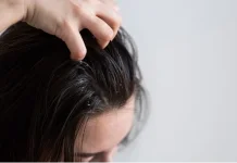 5 Cara Merawat Kulit Kepala yang Sensitif