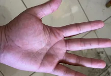 Mitos Garis Tangan: Benarkah Dapat Meramalkan Nasib Seseorang?