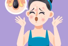 Jerawat Gatal, Kenali Penyebab dan Cara Mengatasinya