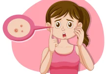 Bukan Sekadar Jerawat, Ini Alasan Kulit Bisa Terasa Gatal