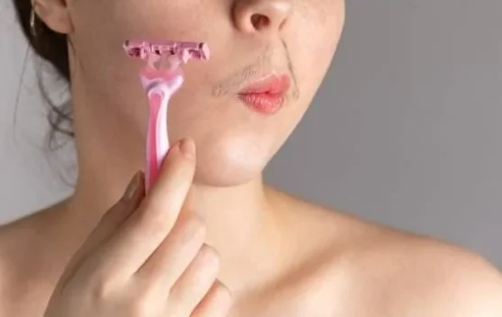Pilihan Cara Menghilangkan Kumis Tipis pada Wanita