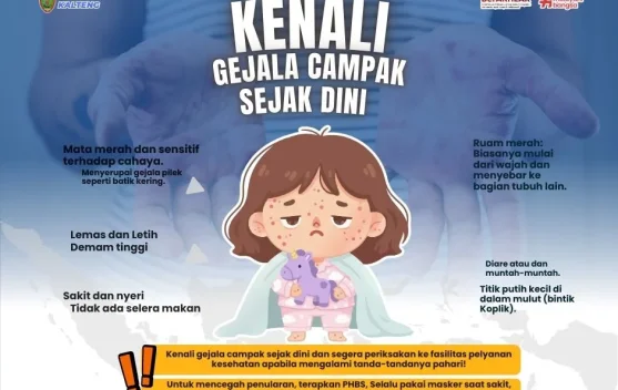 Anak Campak Tidak Boleh Mandi dan Kena Angin? Begini Penjelasan Medis