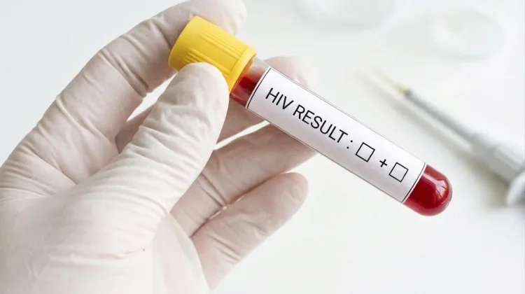 Stigma Jadi Hambatan, Kesadaran Tes HIV di Samarinda Masih Rendah