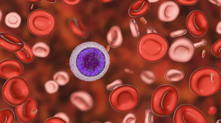 Kelainan Genetik, Kenali Perbedaan Thalasemia Dengan Anemia Biasa