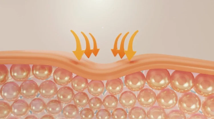 Mengenal Skin Barrier: Kunci Kulit Sehat yang Sering Diabaikan