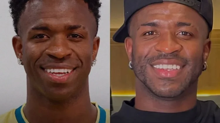 Vinicius Junior Dikabarkan Jalani Harmonisasi Dagu, Penampilan Baru Jadi Sorotan