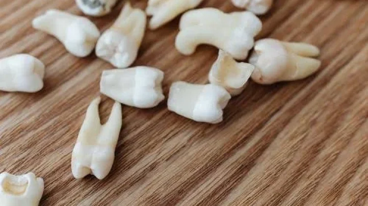 Nyeri dari Telinga hingga Leher? Kenali Ciri Gigi Bungsu Abnormal