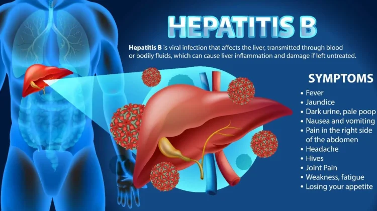 Hepatitis B Ancam 6,7 Juta Penduduk Indonesia, Kenali Gejala Dini dan Pencegahannya