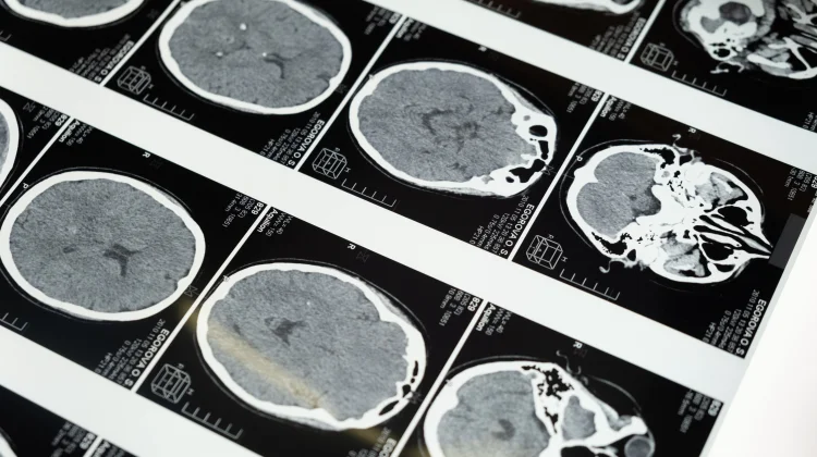 Amar Makruf Nahi Mungkar Ditinjau dari Neurosains
