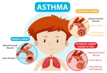 Global Initiative for Asthma Dorong Edukasi Asma Tingkatkan Kualitas Hidup