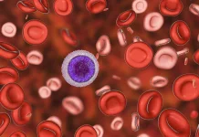 Kelainan Genetik, Kenali Perbedaan Thalasemia Dengan Anemia Biasa