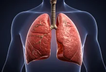 Berhenti Merokok Tak Harus Beralih ke Vape