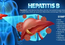 Hepatitis B Ancam 6,7 Juta Penduduk Indonesia, Kenali Gejala Dini dan Pencegahannya