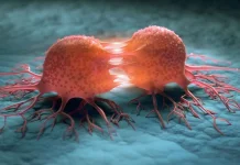 Pahami Perbedaan Tumor dan Kanker Menurut Pakar Kesehatan