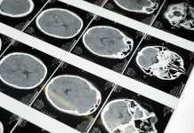 Amar Makruf Nahi Mungkar Ditinjau dari Neurosains