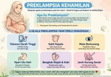 Mengenal Preeklamsia : Keracunan Kehamian yang Tidak Boleh Dianggap Sepele